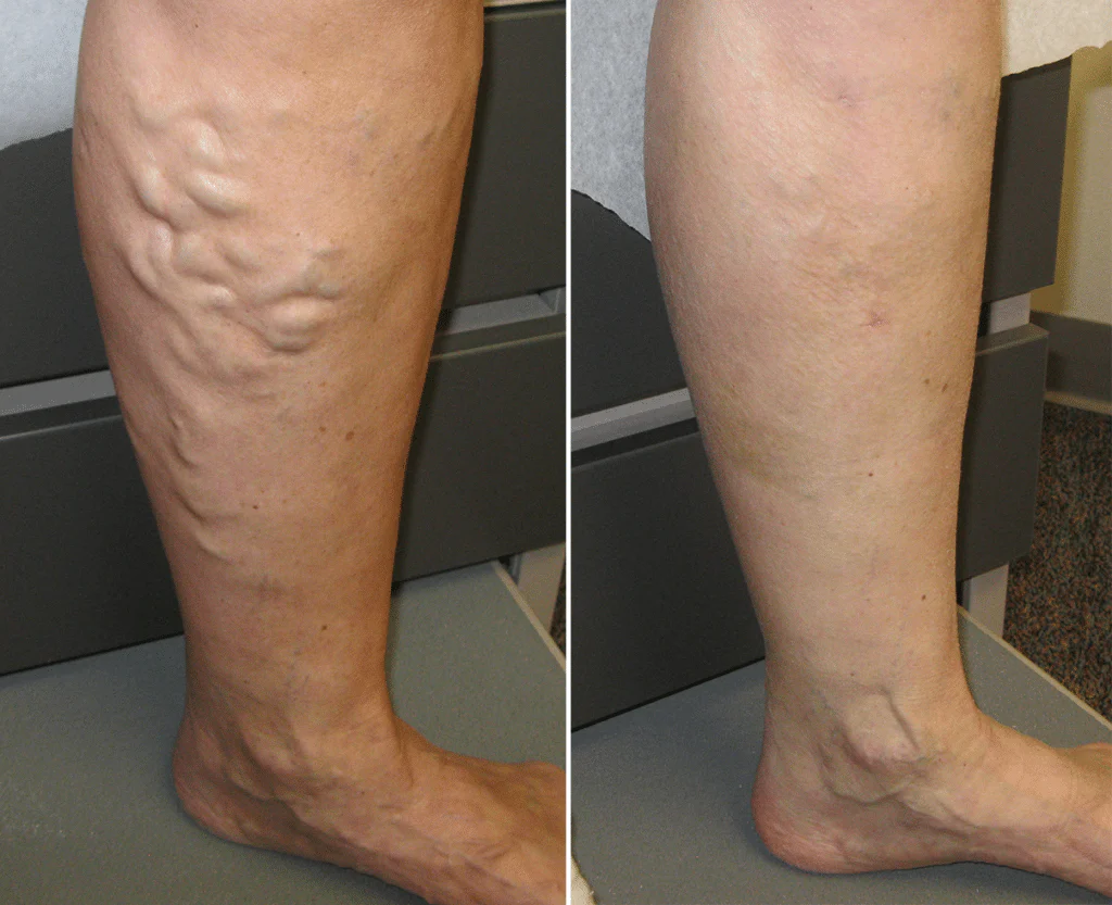 SmoothSpine™ Hyper Grip Compression Socks - Image 3